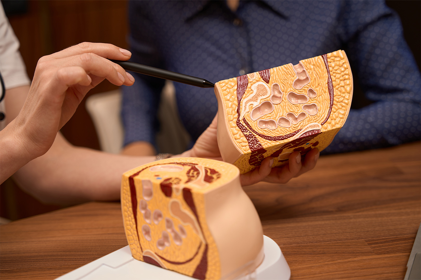 Maqueta del suelo pélvico.