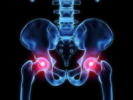 Diferencia entre pelvis y cadera