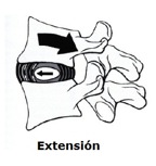 Disco vertebral durante una extensión