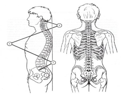 Cada punto en el que se pasa de una curva de la columna vertebral a otra se denomina charnela