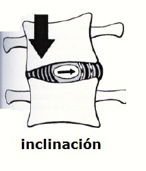 Inclinación vértebra al hacer flexión de columna