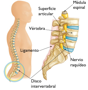 Esquema lumbalgia