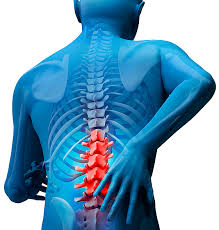 Representación lumbalgia