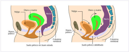 Suelo pélvico sano y debilitado